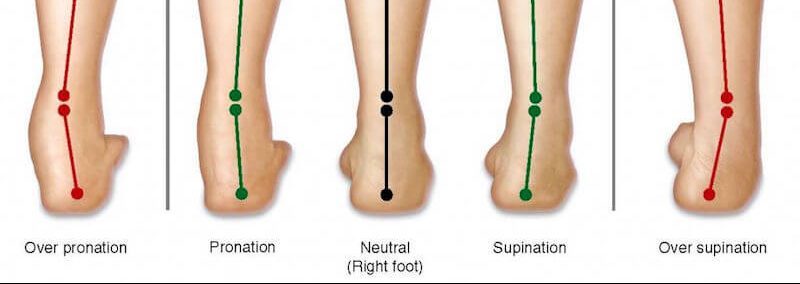 Orthotics for Common Foot Ailments - Pronation & Supination